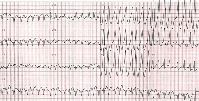 415692011ArticleBFnrcardio201115Fig1HTML 415692011ArticleBFnrcardio201115Fig1HTML