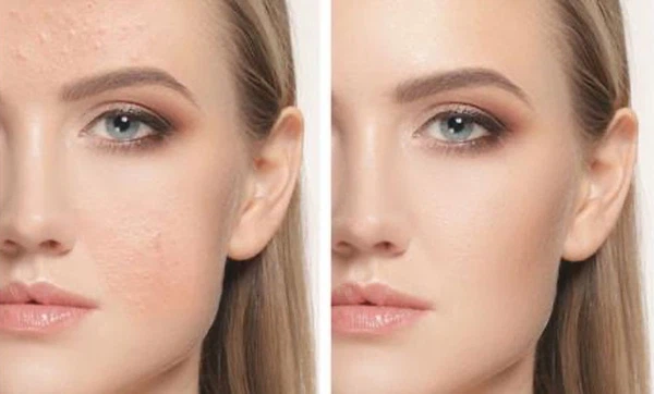 uneven-skin-tone-1 uneven-skin-tone-1