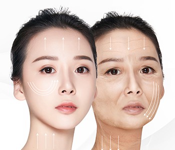 Iššūkis 0 raukšlės, jaunas, bet ne senas