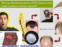 Kodėl DHT tapo pagrindiniu prostatos ir plaukų tyrimų tikslu?