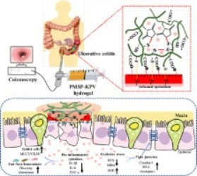 Gut Health and Inflammatory Bowel Disease IBD